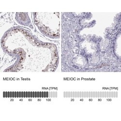 Meiosis 1 Associated Protein Antibody, Novus Biologicals 0.1mL; Unlabeled:Antibodies,